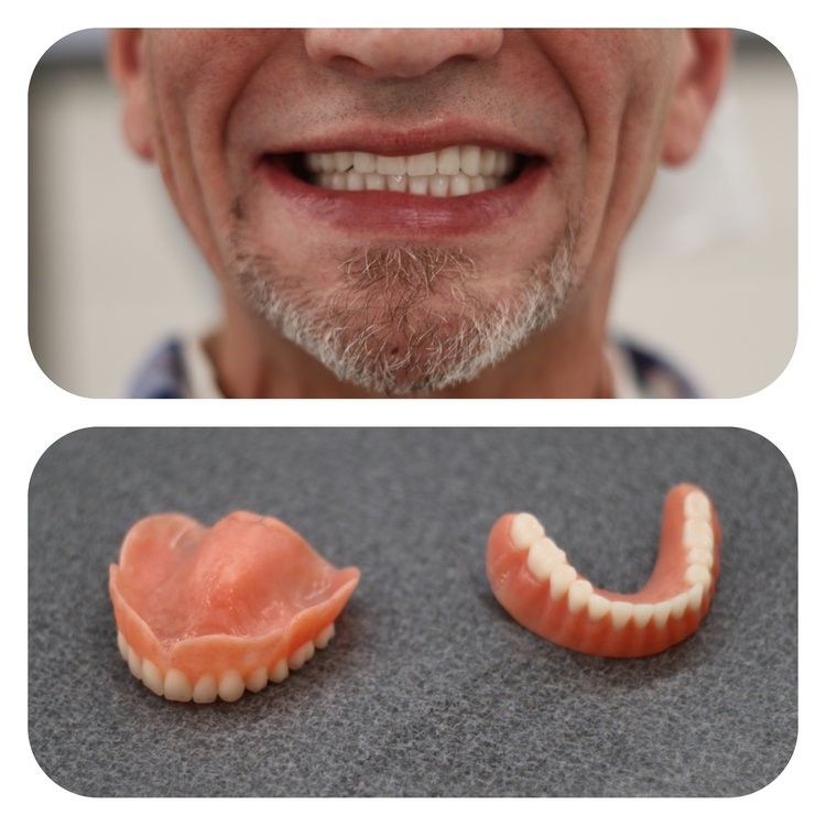 Densurefit For Lower Dentures Pinehill NM 87357